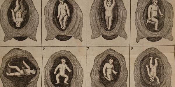 Remedies for Women’s and Children’s Ailments in an Early Modern Yiddish Health Manual